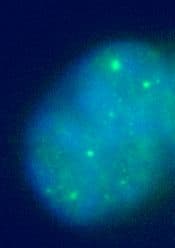 Anti-Sumo 2 + Sumo 3 antibody(AB3742)