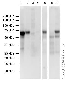 Anti-Estrogen Receptor alpha antibody [E115] - ChIP Grade(ab32063)