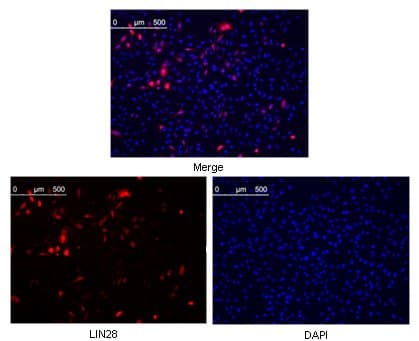 Anti-Lin28A antibody [6D1F9](AB76369)