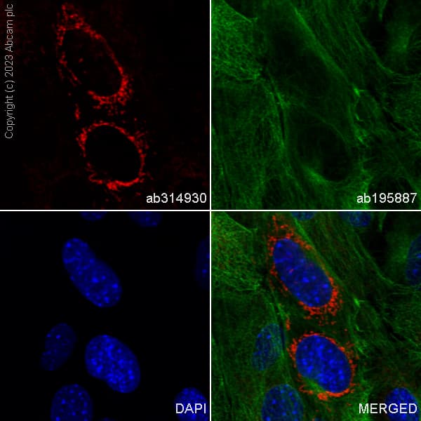 Alexa Fluor 647 Mthfd2 Antibody Epr26938 20 Ab314930  Immunocytochemistry Immunofluorescence Img422264