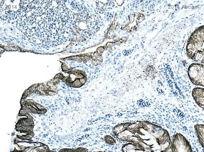Anti-pan Cytokeratin antibody [AE1/AE3 + 5D3](AB86734)