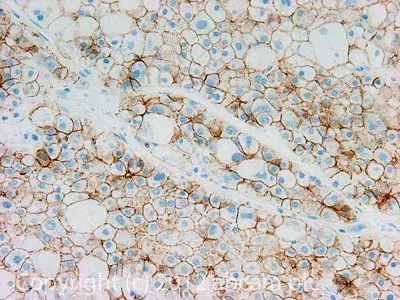 Anti-N Cadherin antibody - Intercellular Junction Marker(AB18203)
