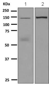 Ceruloplasmin Antibody Epsisr6 42 Ab157452  Western Blot Img65497