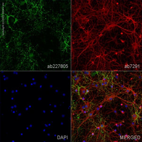 Anti-VGluT1 antibody [EPR22269](ab227805)