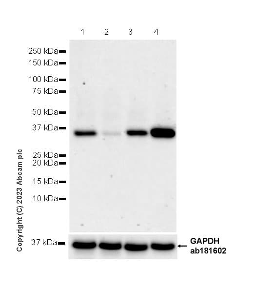 Anti-Aldose reductase antibody [EPR28780-7] - BSA and Azide free(AB316017)