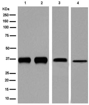 Anti-DDAH1 antibody [EPR13922](AB180599)