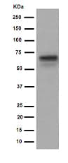 Anti-HAI-1 antibody [EPR15652](AB189511)