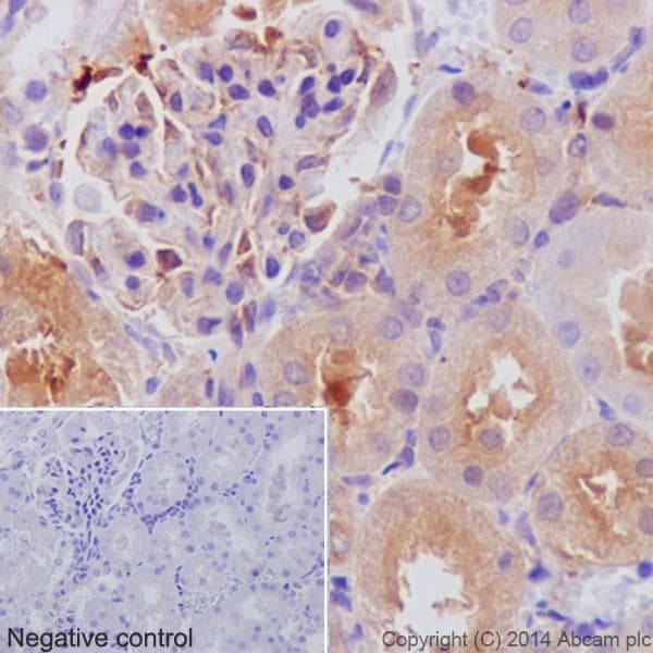 Anti-alpha Tubulin antibody [EP1332Y] - Microtubule Marker(AB52866)