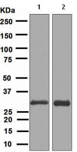 Anti-FRAT1 antibody [EPR3900](AB108405)