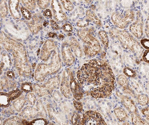 Anti-LAMP1 antibody - Lysosome Marker(AB24170)