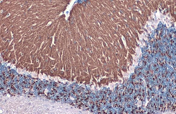 Anti-VGluT1 antibody(AB272913)