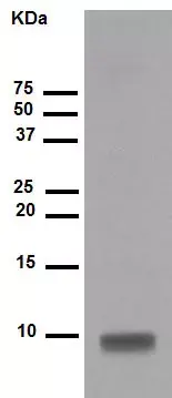 Anti-S100 beta antibody [EP1576Y] - Astrocyte Marker(AB52642)