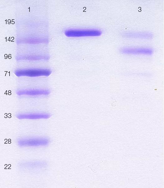 Human Ige Protein Azide Free Ab65866 Sds Page Img91691