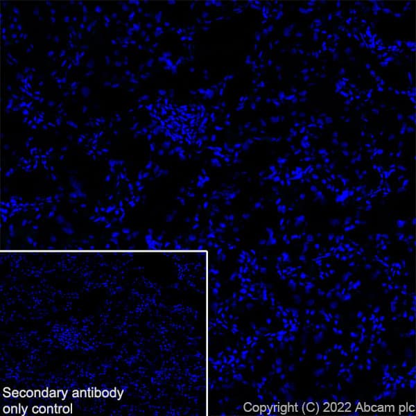 Anti-Aquaporin 5 antibody [EPR27474-70] - BSA and Azide free(AB305304)