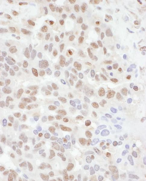 Anti-ADAR1 antibody(AB168809)