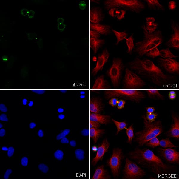 Anti-Aurora B antibody(AB2254)