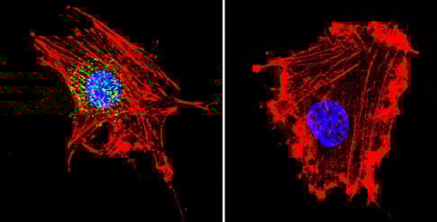 Anti-Parvalbumin antibody(AB11427)