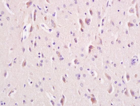 Anti-LRP5 + LRP6 antibody(AB217700)