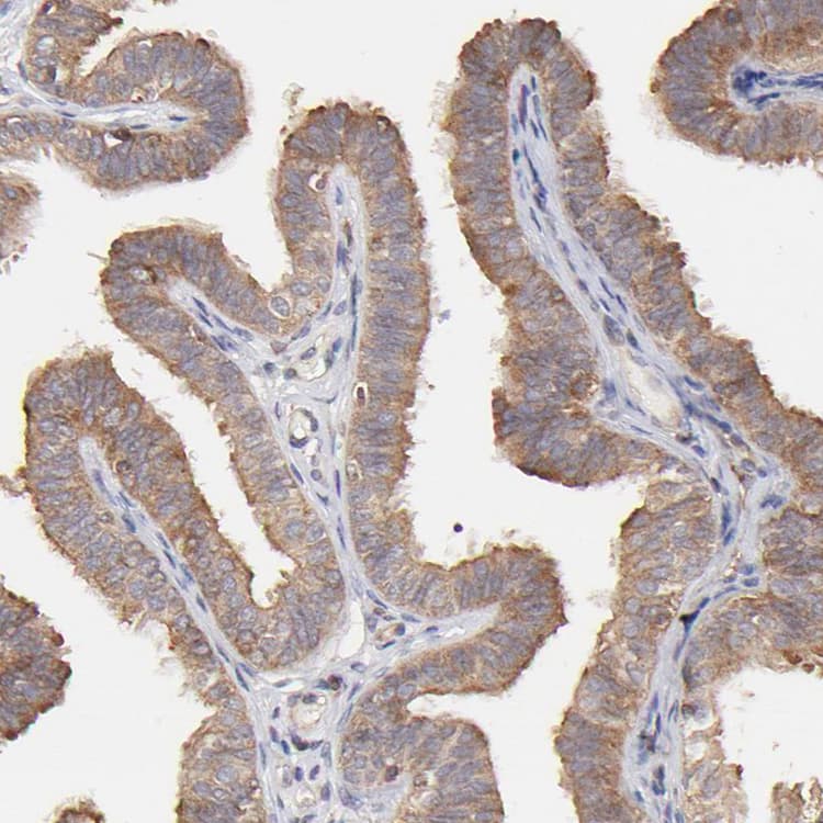 Ston2 Antibody Ab121165  Immunohistochemistry Formalin Pfa Fixed Paraffin Embedded Sections Img81097