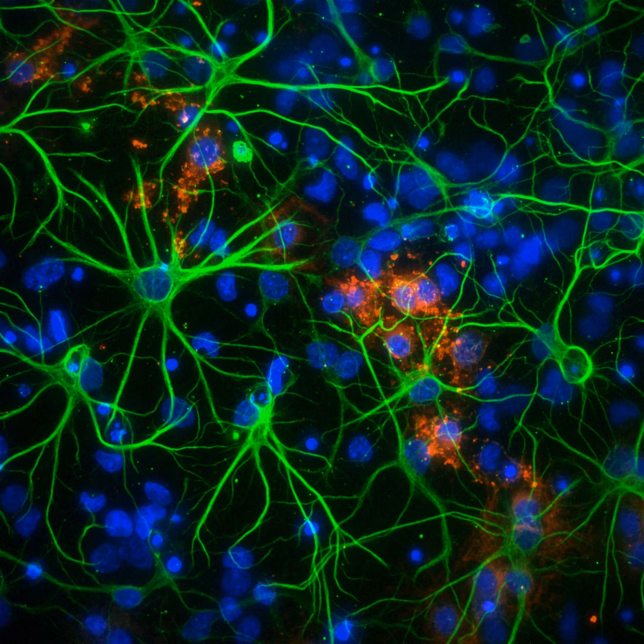 Molecular Devices Micro Confocal High Content Imaging System Image6