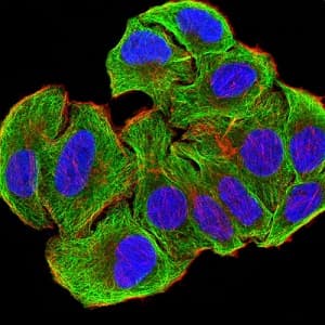 Atg3 Antibody 7a1d1 Ab233560  Immunocytochemistry Immunofluorescence Img37920