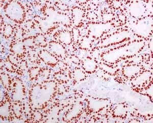 Anti-TTF1/Nkx2-1 antibody [EPR8190-138] - BSA and Azide free(AB227576)