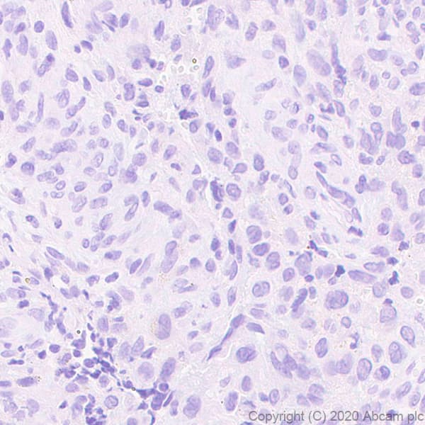 Human Histone H3.3 (Mutated G34W, G34V, G34R) Antibody Panel(AB274410)