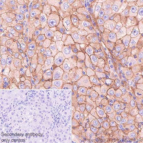Cd276 Antibody Sp206 Ab227670  Immunohistochemistry Formalin Pfa Fixed Paraffin Embedded Sections Img80997