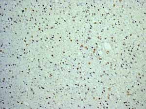 Anti-FOXP1 antibody [EPR4113](AB134055)