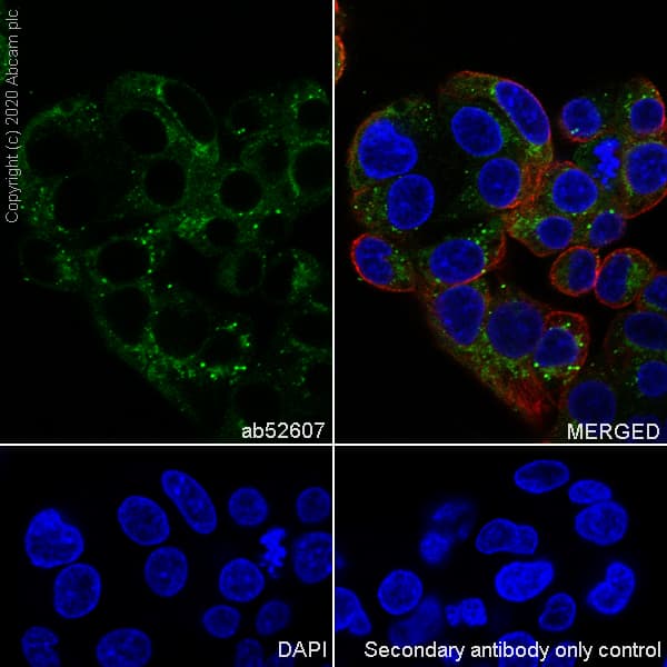 Anti-Apolipoprotein E antibody [EP1374Y](AB52607)