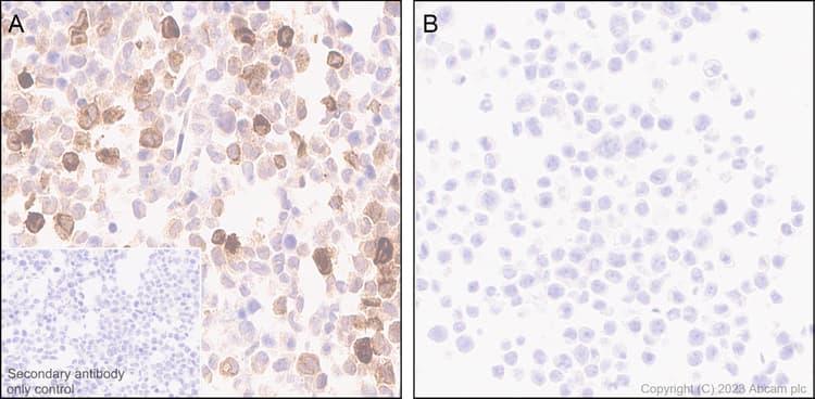 Anti-MCP1 antibody [RM1100](AB315478)