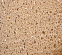 Stathmin 1 Antibody Ep1572 Bsa And Azide Free Ab284789  Immunohistochemistry Formalin Pfa Fixed Paraffin Embedded Sections Img124645