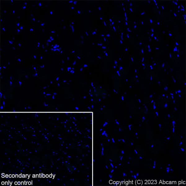 Anti-GABA A Receptor beta 2 antibody [EPR28366-42](AB309540)