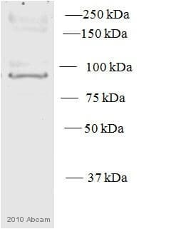 Anti-PKC epsilon antibody(AB63638)
