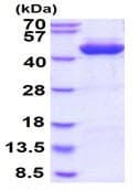 Recombinant Human ADH1C protein(AB128432)