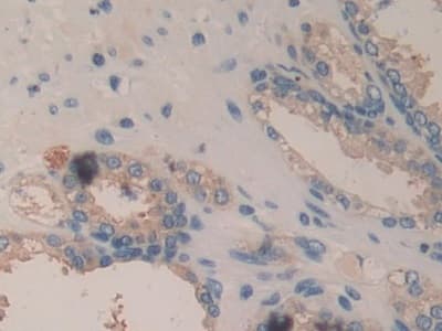 Anti-ITGB6 antibody(AB233519)