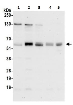 Anti-SNX27 antibody(ab241128)