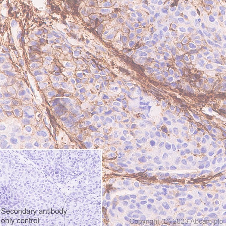 Marcks Antibody Epr28261 90 Bsa And Azide Free Ab315026  Immunohistochemistry Formalin Pfa Fixed Paraffin Embedded Sections Img423774