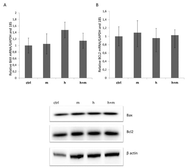 Anti-Actin antibody - Loading Control(AB1801)