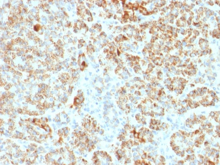 Frataxin Antibody Fxn 2124 Ab268063  Immunohistochemistry Formalin Pfa Fixed Paraffin Embedded Sections Img119752
