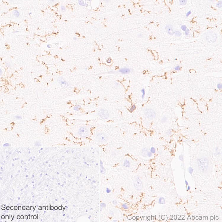 Anti-P2Y12 antibody [EPR26298-93](AB300140)