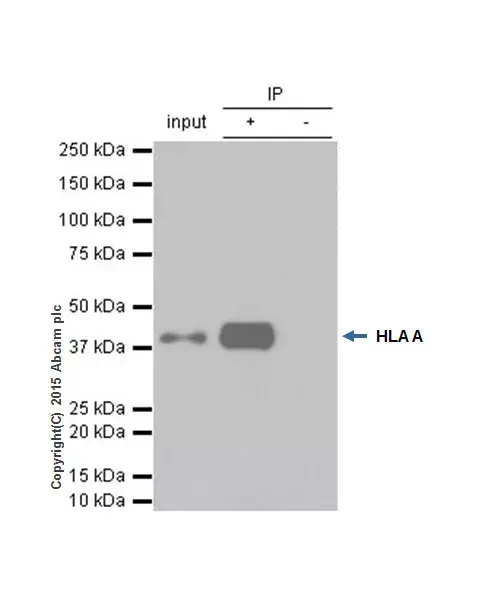 Anti-HLA A antibody [EP1395Y](AB52922)
