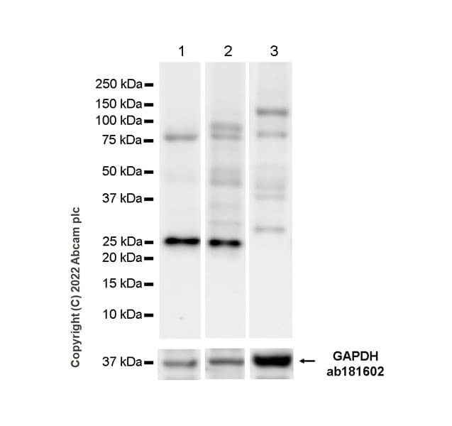 Anti-TAGLN/Transgelin antibody [EPR21206](AB213273)