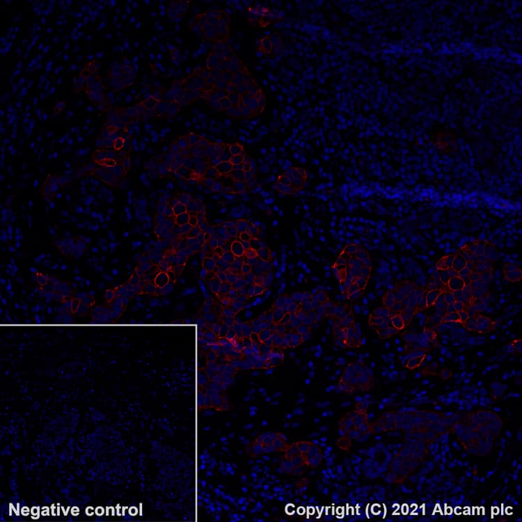 Alexa Fluor® 555 Anti-ErbB2 / HER2 antibody [EP1045Y](AB281782)
