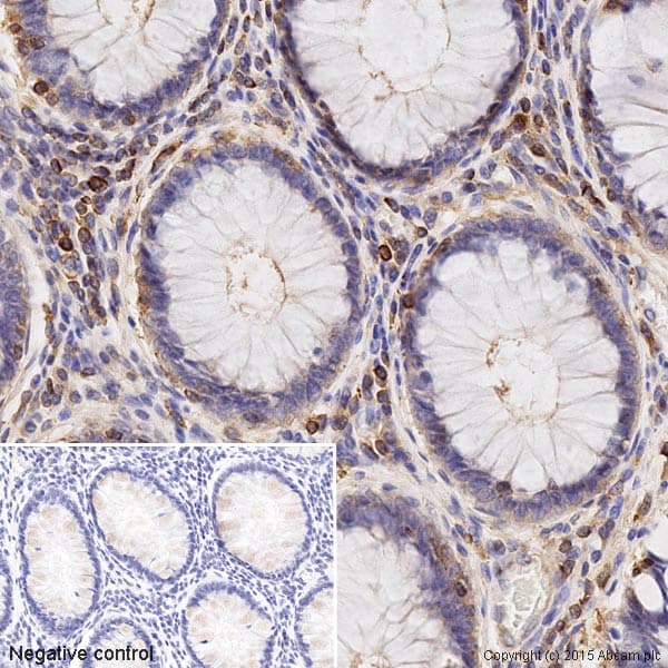 Anti-Actin antibody - Loading Control(AB1801)