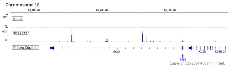 Anti-MASH1/Achaete-scute homolog 1 antibody [EPR19840](AB211327)