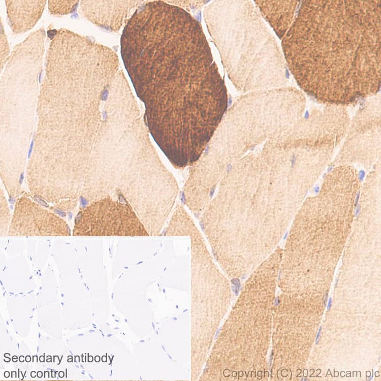 Anti-Cofilin 2 antibody [EPR24519-7](AB300128)