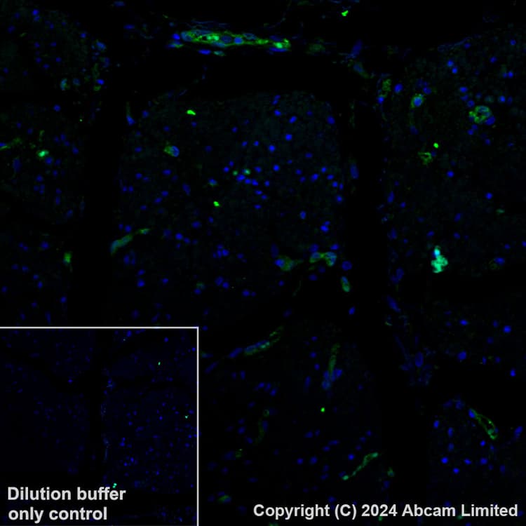 Alexa Fluor 488 Gbp1 Antibody Epr8285 Ab320704  Immunohistochemistry Formalin Pfa Fixed Paraffin Embedded Sections Img435005