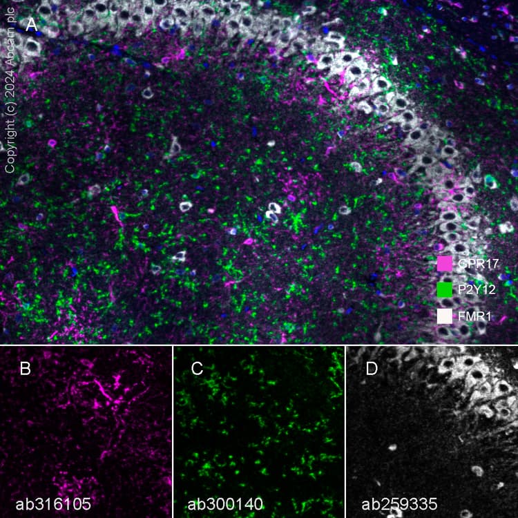 Anti-FMRP antibody [EPR23852-90] - BSA and Azide free(AB277489)