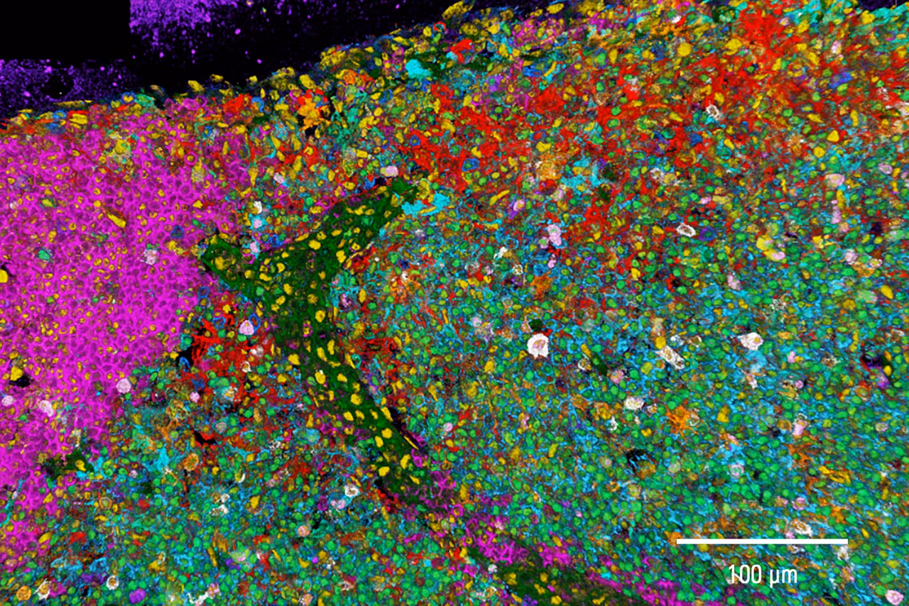 Cell Phenotype Distribution With 3D 15 Plex Imaging In Murine Lymph Node Kid21756187